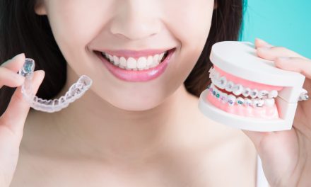 What to Expect From Invisalign Retainer Treatments?