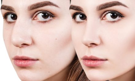 Effects Of Rhinoplasty Before And After Surgery