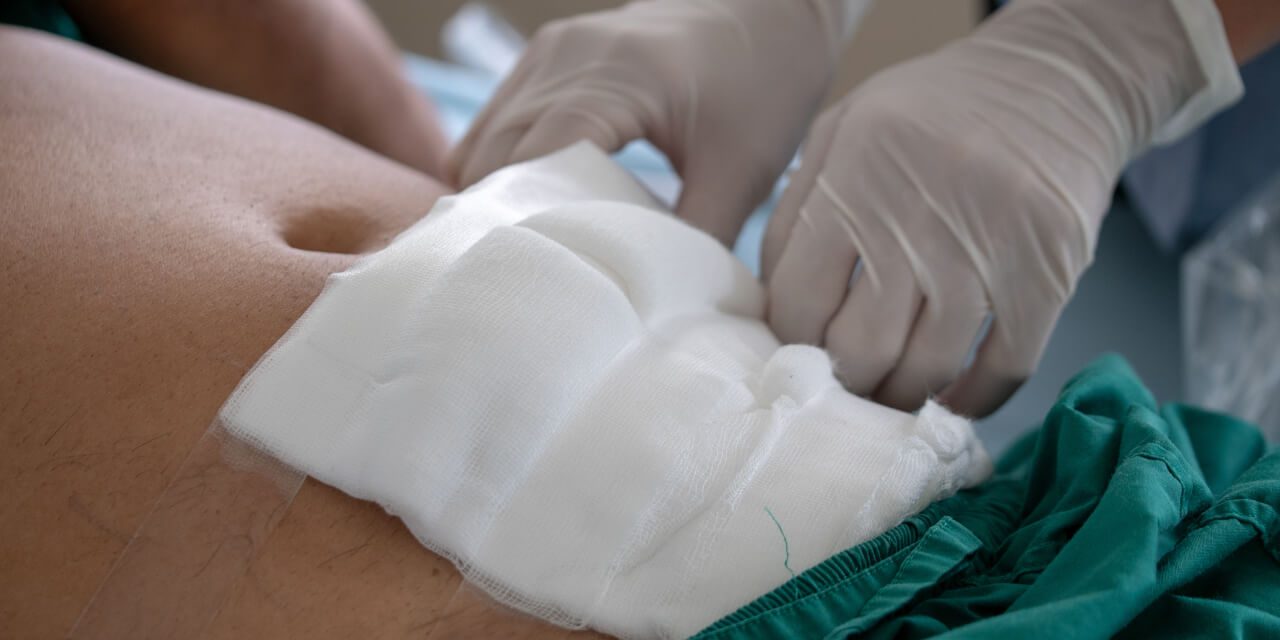 Use of abdominal bandage for large wound dressing