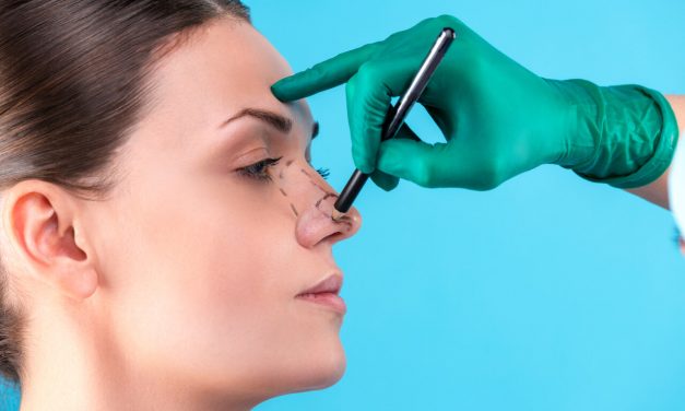 What You Should Know About Rhinoplasty Surgery