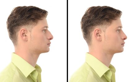 Male Rhinoplasty