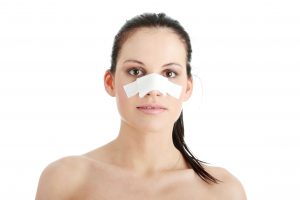 nasal fracture