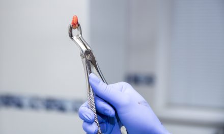 Wisdom tooth removal