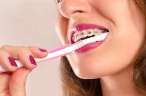 teeth cleaning with braces