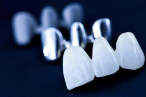 best snap on veneers brands