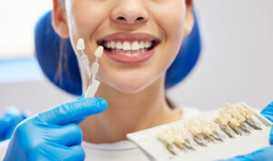 are veneers worth it application